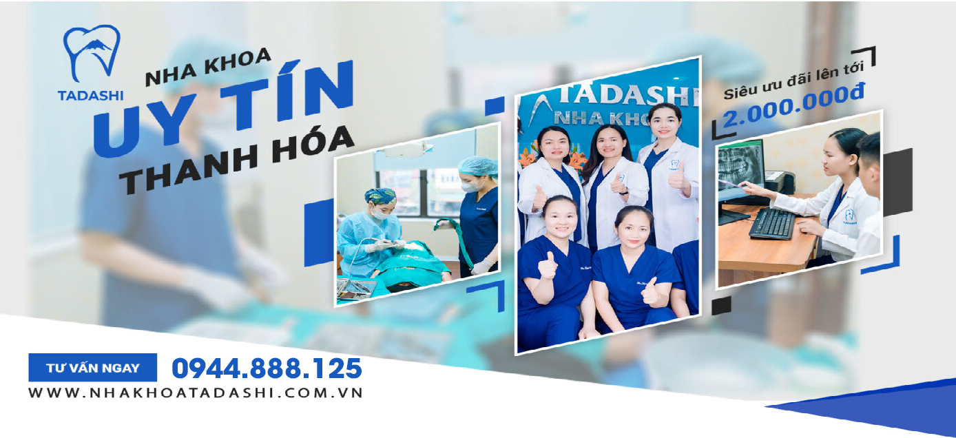 Phòng Khám Nha Khoa Uy Tín Tại Thanh Hóa - Phòng Khám Răng Nha Khoa Tadashi